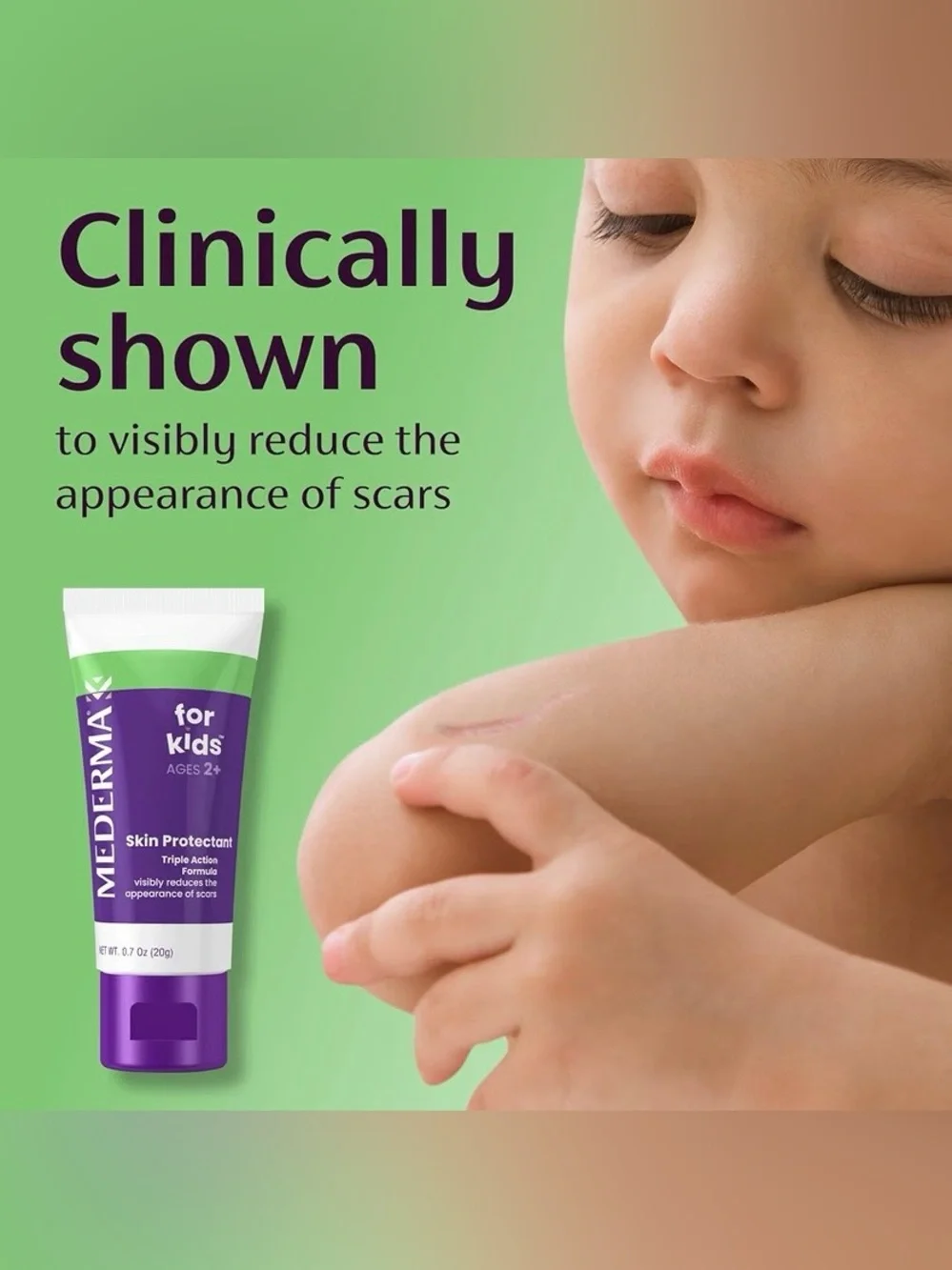 Mederma Scar Gel for Kids Ages 2+ Old & New Scars Cuts Burns Surgery 20g 0.7oz